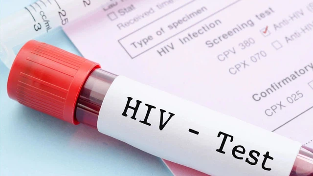 bai-viet/truoc-khi-phau-thuat-co-xet-nghiem-hiv-khong-bien-phap-phong-tranh-lay-nhiem-hiv.html