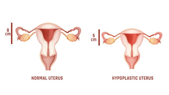 bai-viet/tu-cung-nho-nguyen-nhan-va-nhung-dau-hieu-nhan-biet.html