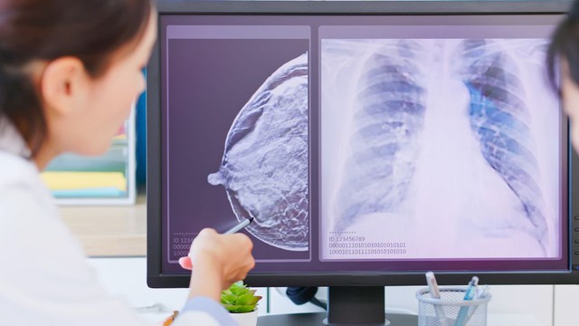 bai-viet/ung-thu-vu-giai-doan-3-song-duoc-bao-lau.html