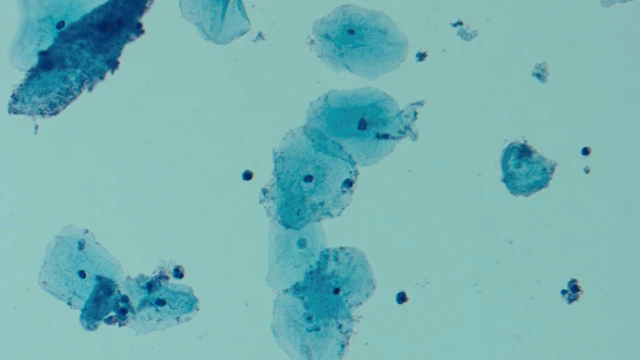 bai-viet/viem-am-dao-do-gardnerella-vaginalis-cach-dieu-tri-va-phong-tranh.html