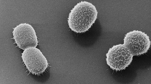 bai-viet/viem-phoi-do-acinetobacter-baumannii-co-nguy-hiem-khong-cach-dieu-tri-the-nao.html