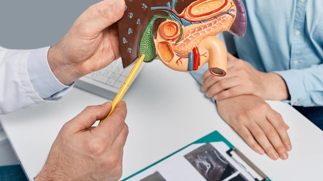 Viêm túi mật cấp