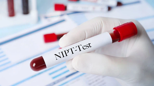 Xét nghiệm NIPT bị sai khi nào? Cách hạn chế nguy cơ kết quả NIPT sai