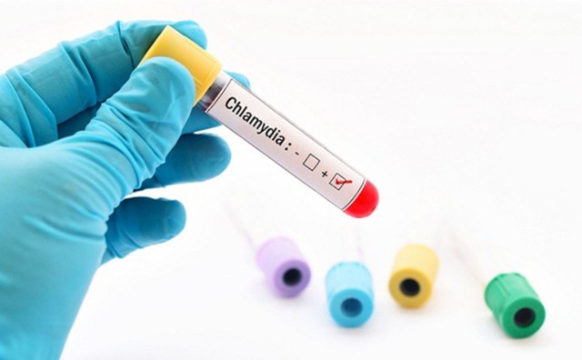 bai-viet/xet-nghiem-chlamydia-la-gi-va-y-nghia-cua-xet-nghiem-68710.html