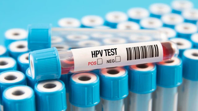 bai-viet/xet-nghiem-hpv-bao-lau-1-lan-loi-khuyen-cho-tung-doi-tuong-cu-the.html