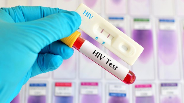 bai-viet/tim-hieu-ve-cac-loai-xet-nghiem-hiv-sau-khi-dung-pep.html