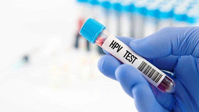 bai-viet/xet-nghiem-hpv-cho-nam-o-dau-goi-y-cac-dia-chi-uy-tin.html