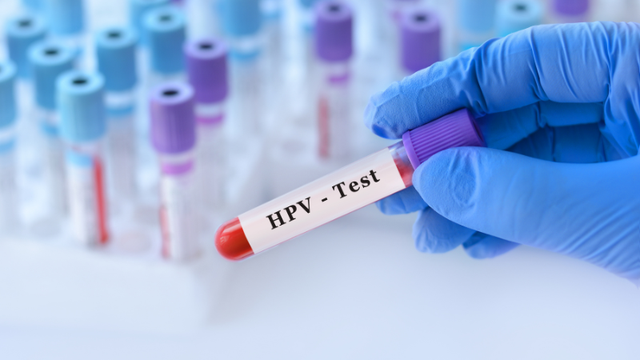 bai-viet/xet-nghiem-hpv-nam-gioi-khi-nao-nen-thuc-hien.html