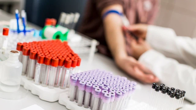 bai-viet/xet-nghiem-mau-tong-quat-het-bao-nhieu-tien-yeu-to-anh-huong-den-chi-phi.html