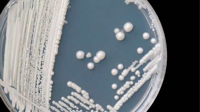 Xét nghiệm nấm Candida: Gồm những gì và khi nào cần thực hiện?