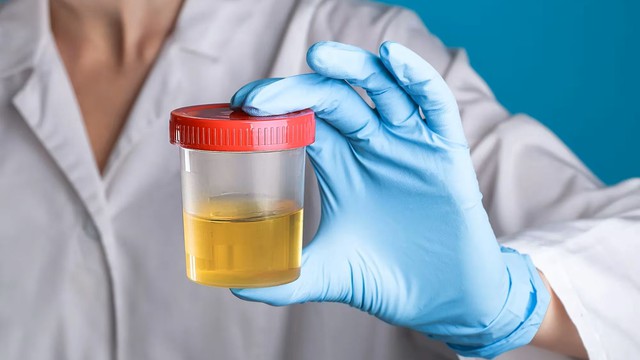 bai-viet/xet-nghiem-tieu-duong-thai-ky-bang-nuoc-tieu-co-chinh-xac-khong.html