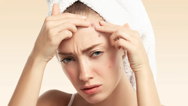 bai-viet/xoa-tan-noi-lo-ve-mun-mu-voi-derma-angel.html
