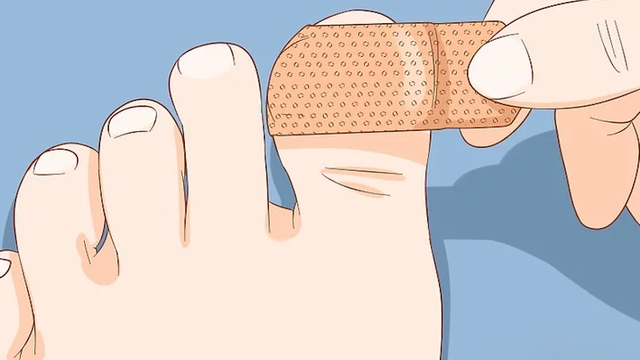 bai-viet/cach-cham-soc-mong-chan-bi-bat-an-toan-tai-nha-69526.html