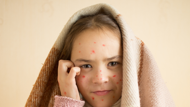 bai-viet/huong-dan-cach-ve-sinh-vung-kin-khi-bi-thuy-dau-va-nhung-luu-y-can-biet.html