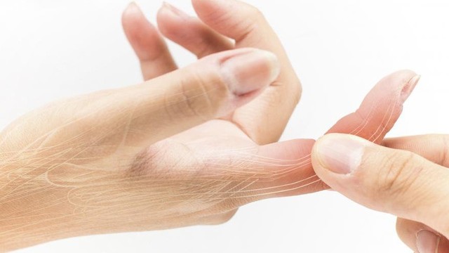 bai-viet/huong-dan-so-cuu-dap-ngon-tay-dung-cach-53337.html