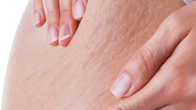 bai-viet/huong-dan-tri-ran-da-mong-bang-dau-dua-dung-cach-56534.html