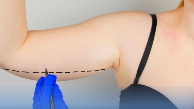 bai-viet/hut-mo-bap-tay-co-nguy-hiem-khong-66269.html