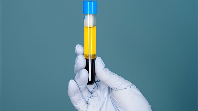 bai-viet/huyet-thanh-la-gi-huyet-thanh-co-vai-tro-the-nao-voi-suc-khoe-con-nguoi-63953.html