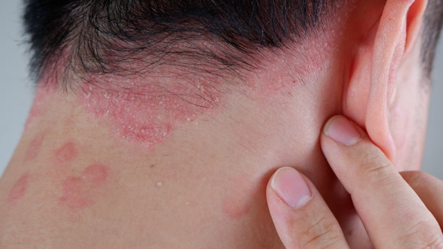 bai-viet/cach-lua-chon-dau-goi-tri-vay-nen-da-dau-dat-hieu-qua-cao.html