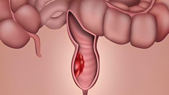 bai-viet/k-truc-trang-thap-nguyen-nhan-trieu-chung-va-cach-dieu-tri.html