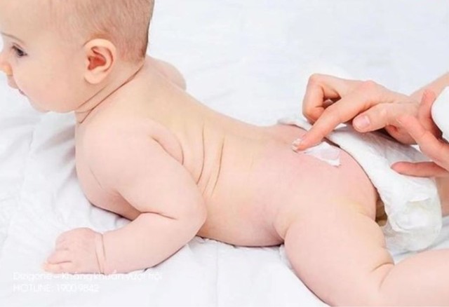 bai-viet/kem-duong-am-chong-ham-cach-phong-ngua-ham-da-o-tre-hieu-qua.html