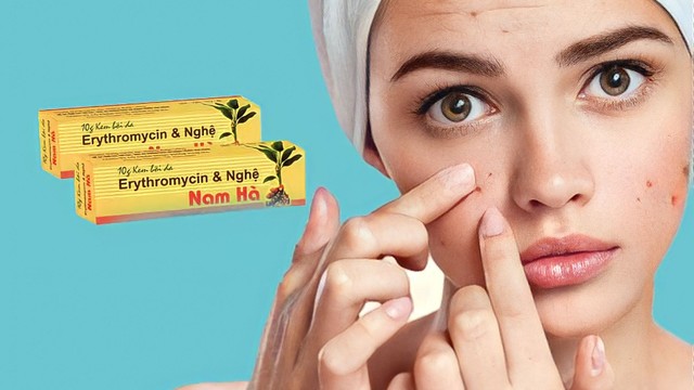 bai-viet/kem-nghe-nam-ha-review-co-that-su-tot-khong-co-nen-su-dung-hay-khong.html