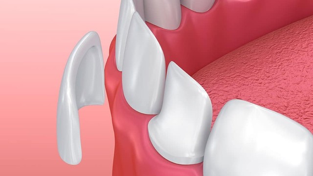 bai-viet/keo-dan-rang-su-la-gi-mua-keo-dan-rang-su-o-dau-64607.html