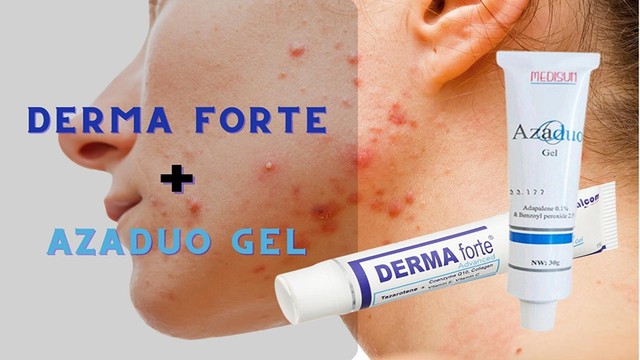 bai-viet/ket-hop-azaduo-va-derma-forte-co-giup-tri-mun-hieu-qua-hon.html