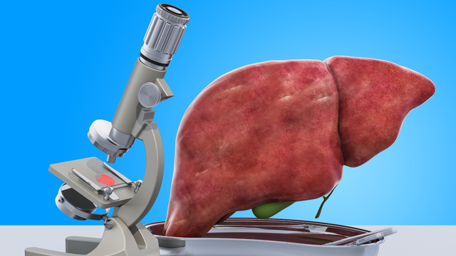 bai-viet/ket-qua-do-muc-do-xo-hoa-gan-co-y-nghia-nhu-the-nao-quy-trinh-thuc-hien-do.html