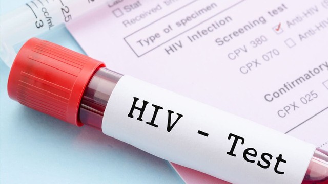bai-viet/ket-qua-xet-nghiem-hiv-bao-gom-nhung-loai-nao.html