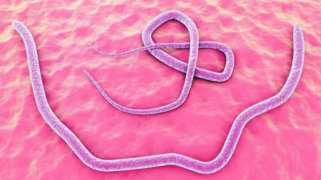 bai-viet/ket-qua-xet-nghiem-toxocara-igg-la-pos-3-5-od-nghia-la-gi.html