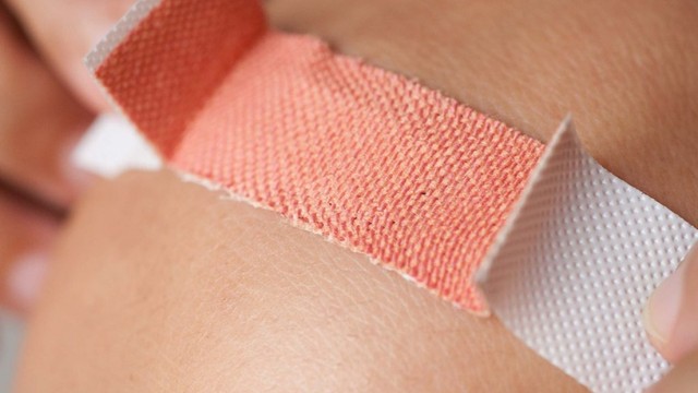 bai-viet/khac-phuc-da-tay-kho-nut-ne-chay-mau-bang-cach-nao-61137.html