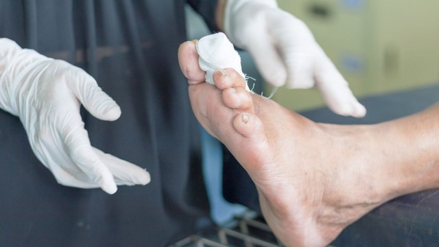 bai-viet/tam-quan-trong-va-quy-trinh-thuc-hien-kham-ban-chan-dai-thao-duong.html