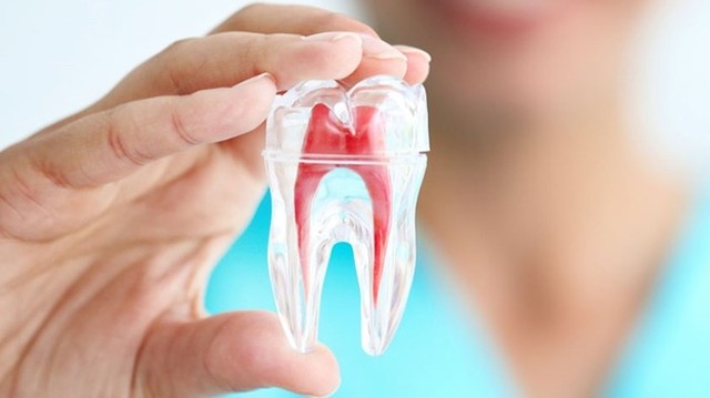 bai-viet/kham-pha-ngay-khi-nao-tram-rang-lay-tuy-la-can-thiet.html