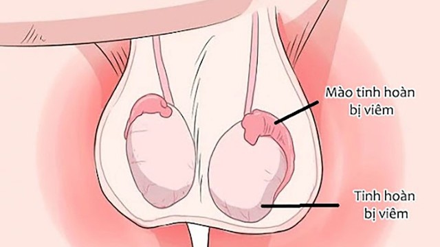 bai-viet/kham-tinh-hoan-co-the-phat-hien-nhung-benh-ly-gi.html