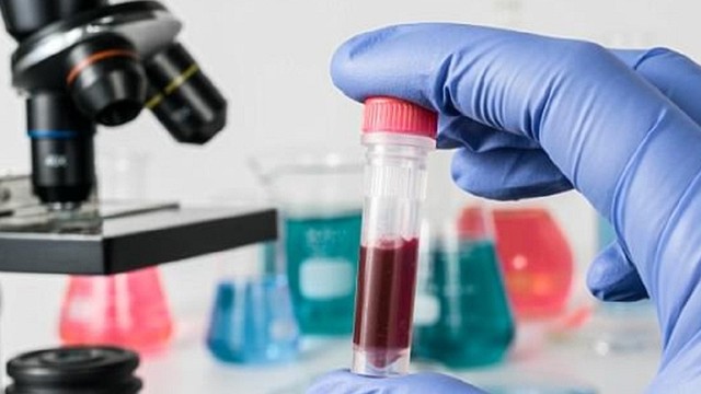 bai-viet/cardiolipin-antibody-la-gi-khi-nao-can-thuc-hien-xet-nghiem-khang-the-khang-cardiolipin-antibody.html