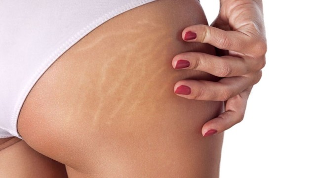 bai-viet/khe-mong-bi-tham-nguyen-nhan-va-cach-cai-thien-hieu-qua.html