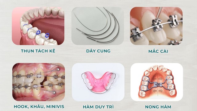 bai-viet/khi-cu-la-gi-vai-tro-cua-khi-cu-trong-nieng-rang.html
