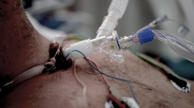 bai-viet/khi-nao-mo-khi-quan-cap-cuu-duoc-thuc-hien.html