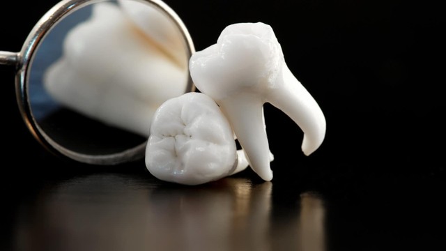 bai-viet/khi-nao-nen-nho-rang-khon-nhung-dieu-can-luu-y.html