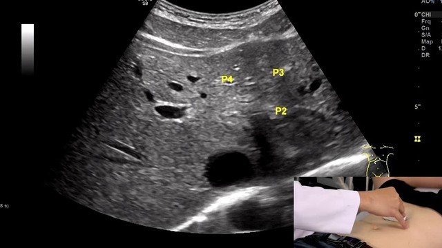 bai-viet/khoi-echo-la-gi-giai-dap-mot-so-thac-mac-ve-khoi-echo-trong-y-hoc.html