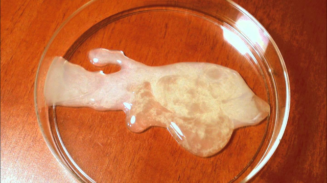 bai-viet/nhung-cach-kiem-tra-tinh-trung-bang-mat-thuong.html