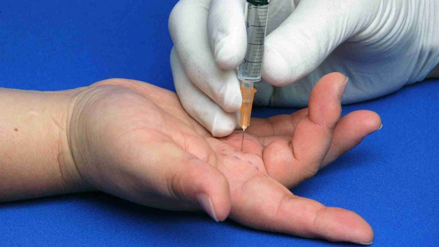 bai-viet/ky-thuat-tiem-gan-gap-ngon-tay-va-nhung-thong-tin-can-biet.html