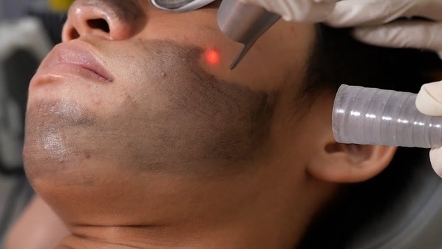 bai-viet/lam-dep-bang-ban-than-hoat-tinh-co-tac-dung-gi-can-luu-y-gi-neu-su-dung-phuong-phap-nay.html