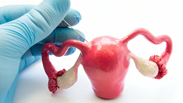 bai-viet/lam-ivf-co-dau-khong-loi-khuyen-de-giam-dau-khi-lam-ivf.html