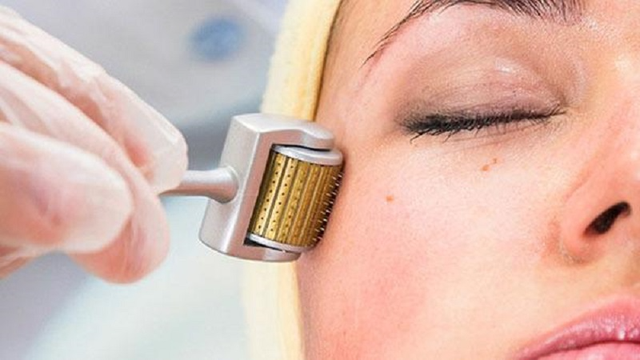 bai-viet/lan-kim-bao-nhieu-tien-co-che-cua-phuong-phap-lan-kim.html