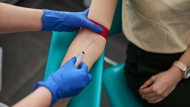 bai-viet/lay-mau-co-dau-khong-cach-giam-dau-khi-lay-mau.html