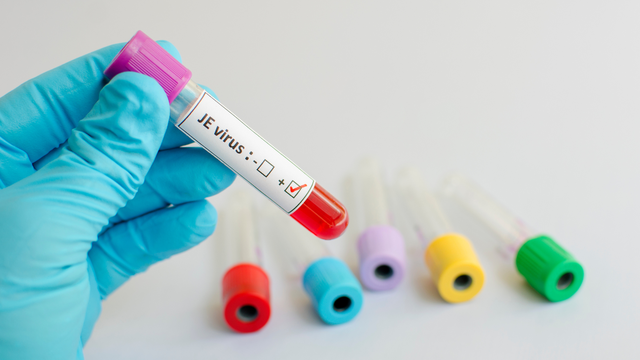 bai-viet/lich-tiem-nhac-dung-chuan-vac-xin-viem-nao-nhat-ban-cho-be-ma-ba-me-thuong-quen.html