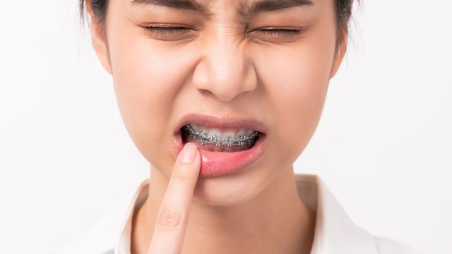 bai-viet/lichen-phang-o-mieng-la-gi-dau-hieu-va-cach-dieu-tri.html