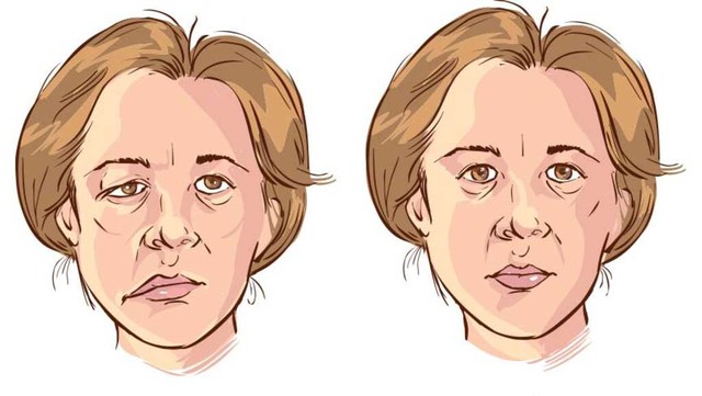 bai-viet/liet-mat-do-lanh-dau-hieu-nhan-biet-va-cach-khac-phuc.html